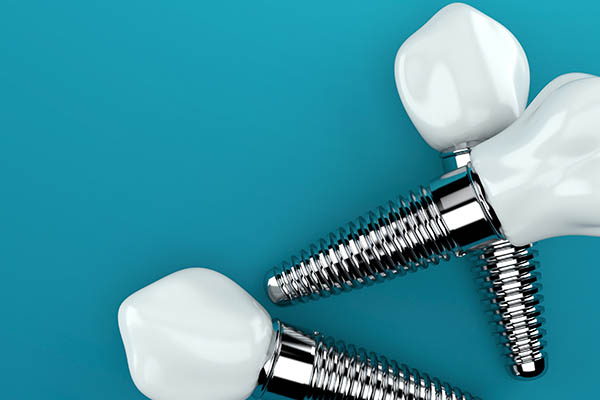 An Implant Dentist Shares About the Tooth Replacement Timeline from Davis & Dingle Family Dentistry in Columbia, SC