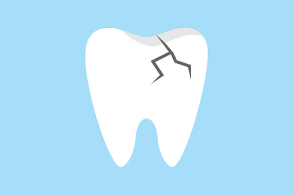 Ask an Implant Dentist About Replacing a Damaged Tooth from Davis & Dingle Family Dentistry in Columbia, SC