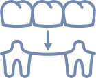 Dental Bridges Icon