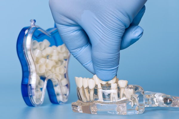 How To Tell If You Are A Candidate For A Dental Bridge