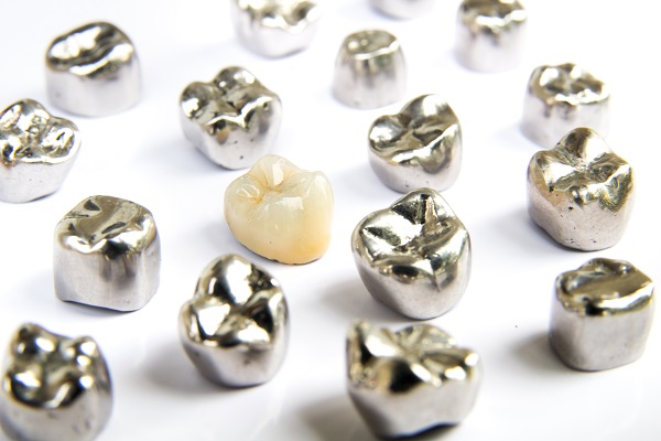 What To Expect In A Dental Crown Procedure