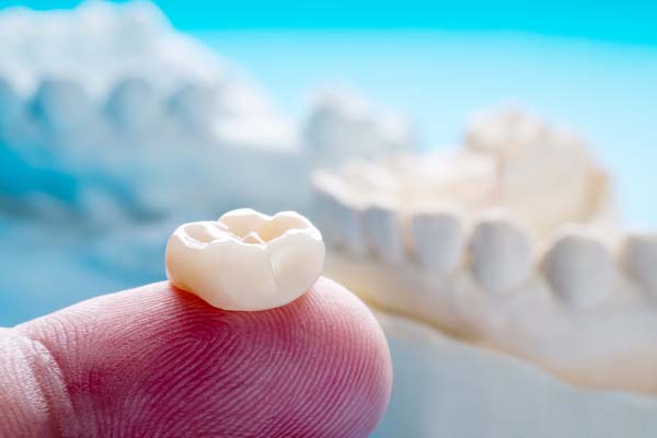 Dental Crowns As A Cosmetic Treatment