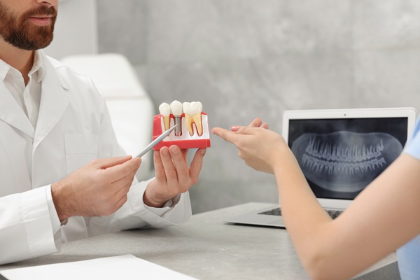 How To Take Care Of A Dental Crown