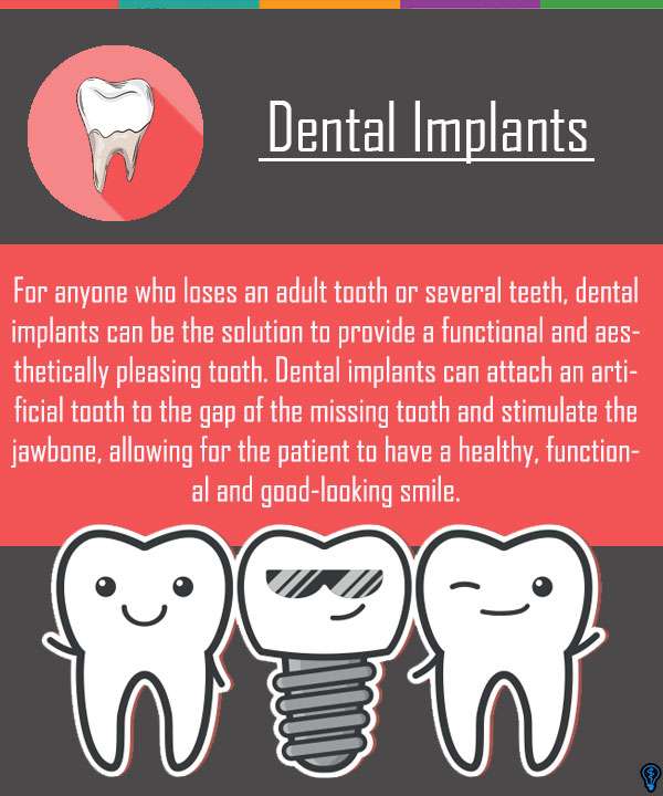Dental Implants Columbia, SC