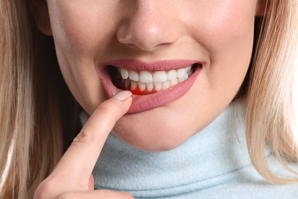 Treating Gum Disease As Part Of Halitosis Treatment