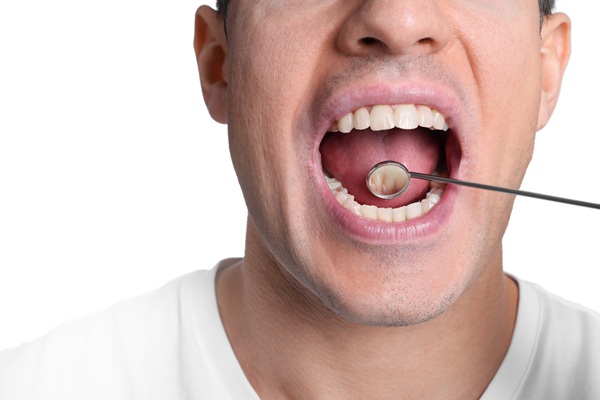 Dental Treatments To Treat Halitosis