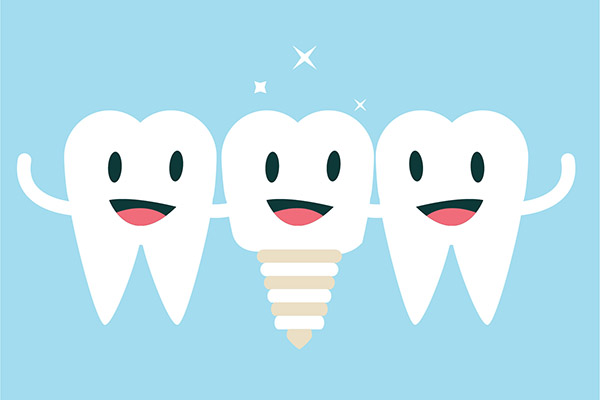 Implant Dentistry Aftercare FAQs from Davis & Dingle Family Dentistry in Columbia, SC