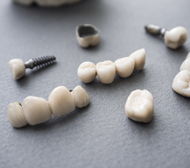 Columbia The Difference Between Dental Implants and Mini Dental Implants
