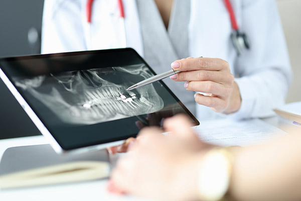 The Importance of Regular Dental Checkup X-Rays from Davis & Dingle Family Dentistry in Columbia, SC
